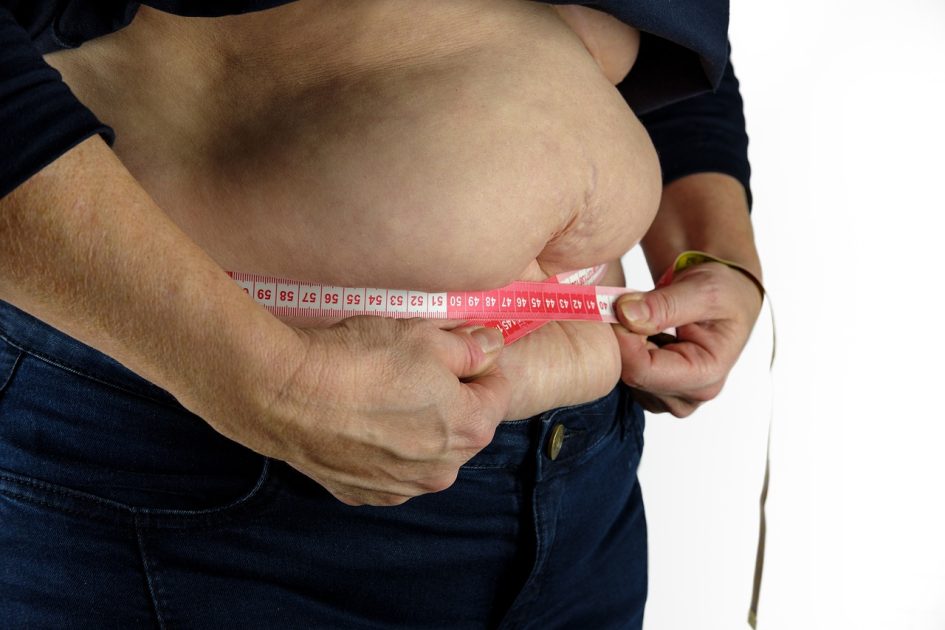 Is it Normal Fat or Lipedema Fat?